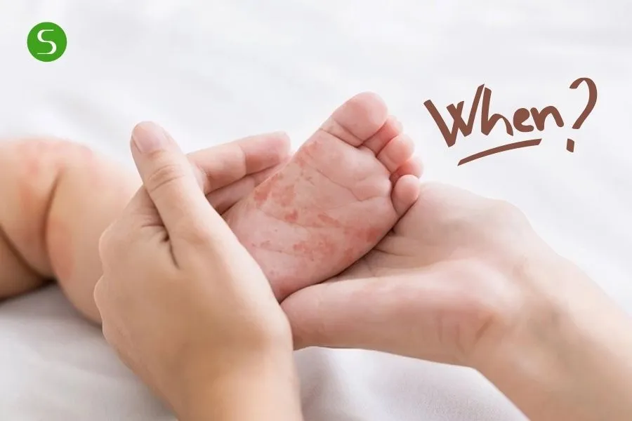 Khi nào bé hết dị ứng đạm sữa bò?