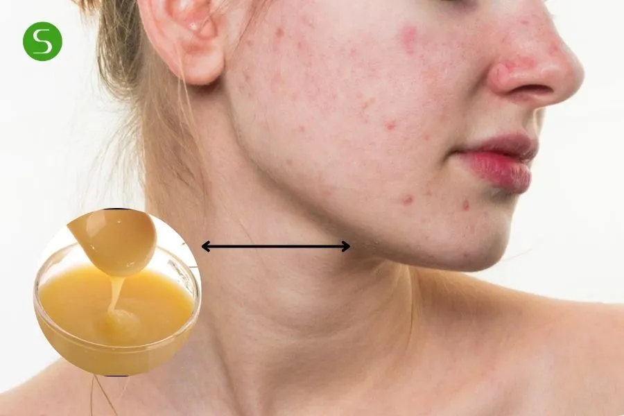 Dấu hiệu nào là đang dị ứng?
