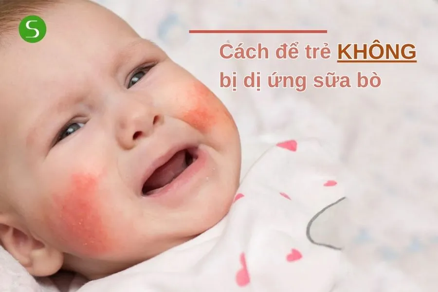 Hướng dẫn cách để trẻ không bị dị ứng sữa bò
