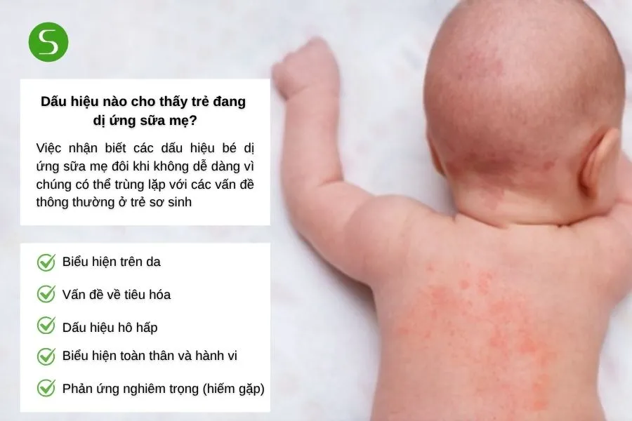 Dấu hiệu nào cho thấy trẻ đang dị ứng sữa mẹ? 